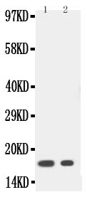 1 - Anti-IL-1 beta Antibody ABO10666