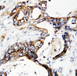 2 - Anti-uPAR Antibody ABO10669