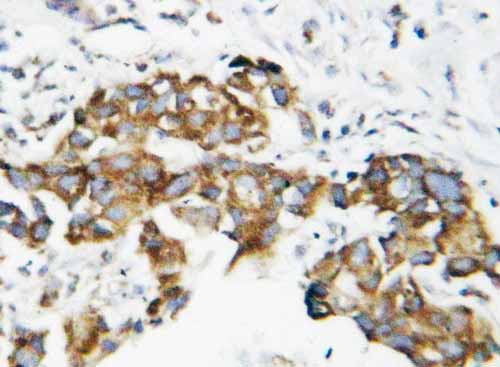 2 - Anti-SOD1 Antibody ABO10670