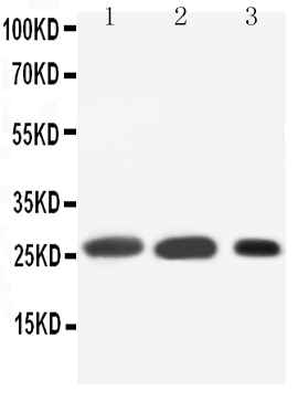 1 - Anti-SFTPA1 Antibody ABO10671