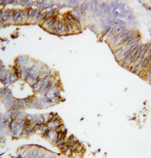 2 - Anti-Annexin A2 Antibody ABO10672