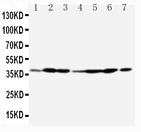 1 - Anti-Annexin A2 Antibody ABO10672