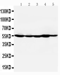 1 - Anti-HDAC2 Antibody ABO10673