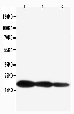 1 - Anti-IL-1 beta Antibody ABO10675