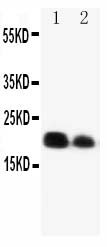 1 - Anti-IL-6 Antibody ABO10676