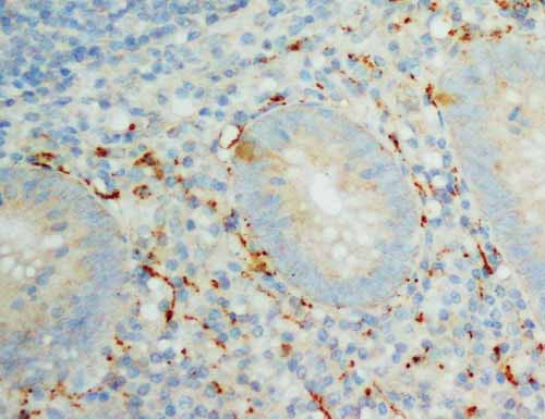 2 - Anti-IL-8 Antibody ABO10677