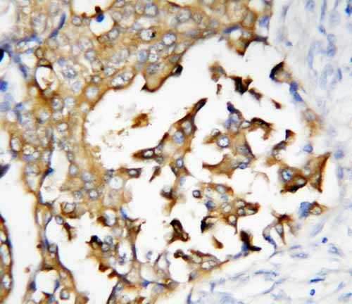 2 - Anti-Presenilin 2 Antibody ABO10681