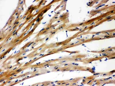 2 - Anti-Presenilin 2 Antibody ABO10681