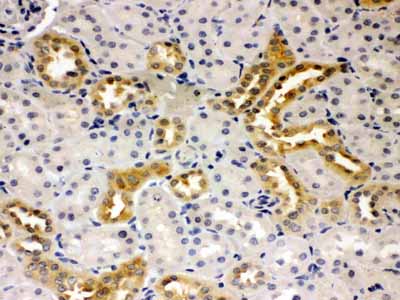 2 - Anti-Presenilin 2 Antibody ABO10681