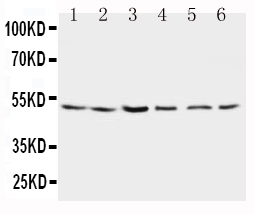 1 - Anti-Presenilin 2 Antibody ABO10681