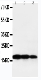 1 - Anti-TNF Beta Antibody ABO10684