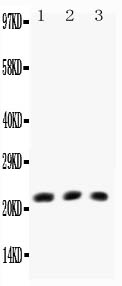 1 - Anti-TNF Beta Antibody ABO10685