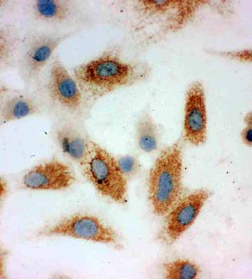 8 - Anti-P-Cadherin Antibody ABO10687