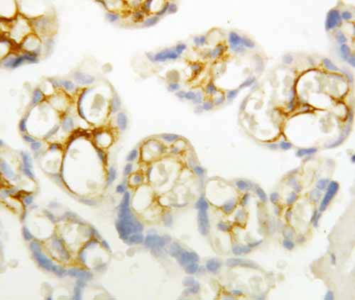 2 - Anti-P-Cadherin Antibody ABO10687