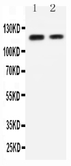 1 - Anti-P-Cadherin Antibody ABO10687