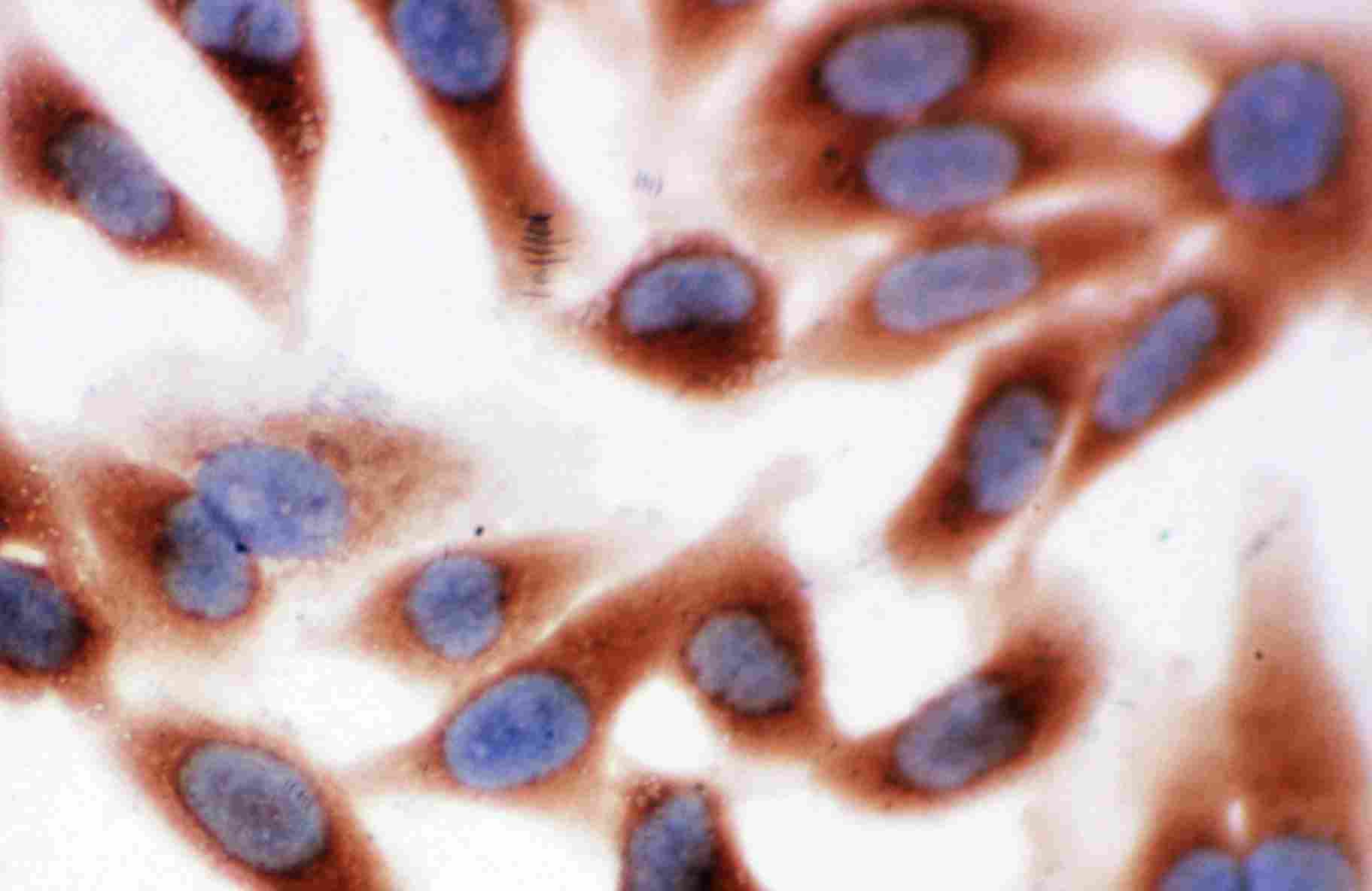 8 - Anti-Calpain 1 Antibody ABO10688