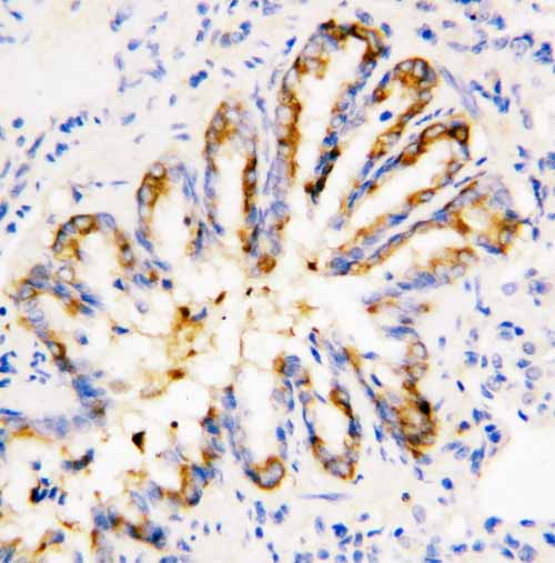 2 - Anti-Calpain 1 Antibody ABO10688
