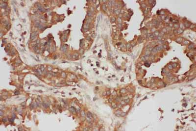2 - Anti-Calpain 1 Antibody ABO10688