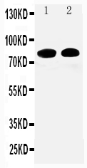 1 - Anti-Calpain 1 Antibody ABO10688