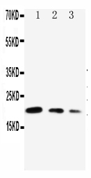 1 - Anti-CDC42 Antibody ABO10691