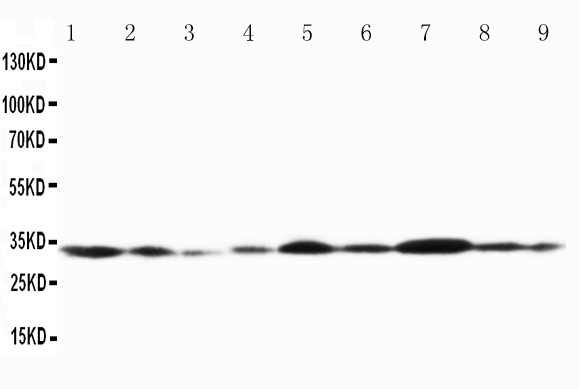 1 - Anti-Connexin 32/GJB1 Antibody ABO10692