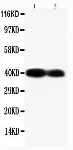 1 - Anti-Connexin 40/GJA5 Antibody ABO10693