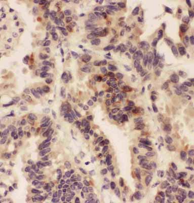 2 - Anti-HSD11B1 Antibody ABO10697