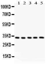 1 - Anti-HSD11B1 Antibody ABO10697