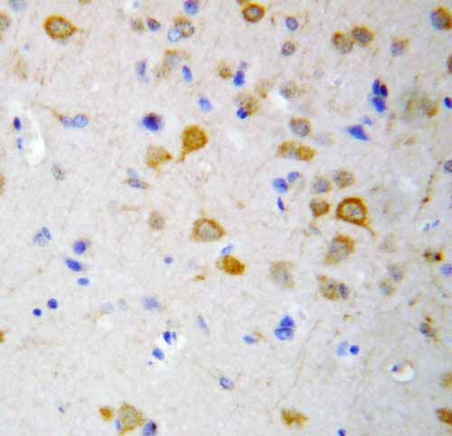 2 - Anti-5HT2A Receptor Antibody ABO10698