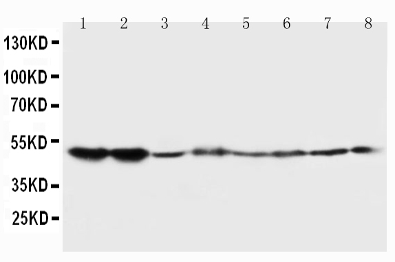 1 - Anti-5HT2A Receptor Antibody ABO10698