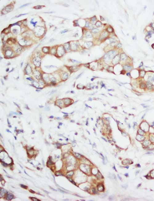 2 - Anti-IGF-1 Antibody ABO10699