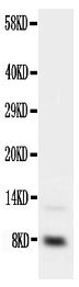 1 - Anti-IGF-1 Antibody ABO10699