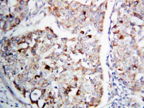 2 - Anti-MEK1 Antibody ABO10700