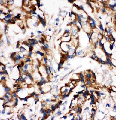 2 - Anti-MEK1 Antibody ABO10700