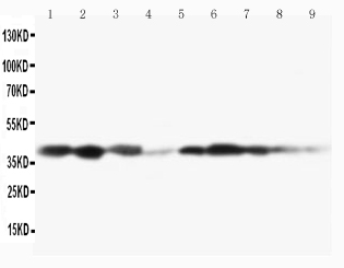 1 - Anti-MEK3 Antibody ABO10701
