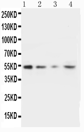 1 - Anti-MMP10 Antibody ABO10706