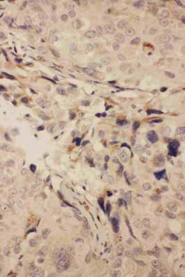 2 - Anti-RANK Antibody ABO10708
