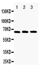 1 - Anti-RANK Antibody ABO10708