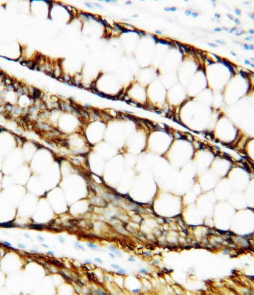 2 - Anti-TIMP-1 Antibody ABO10710