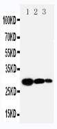 1 - Anti-TIMP-1 Antibody ABO10710