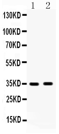 1 - Anti-HSD17B6 Antibody ABO10711