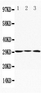 1 - Anti-ApolipoProtein D Antibody ABO10712