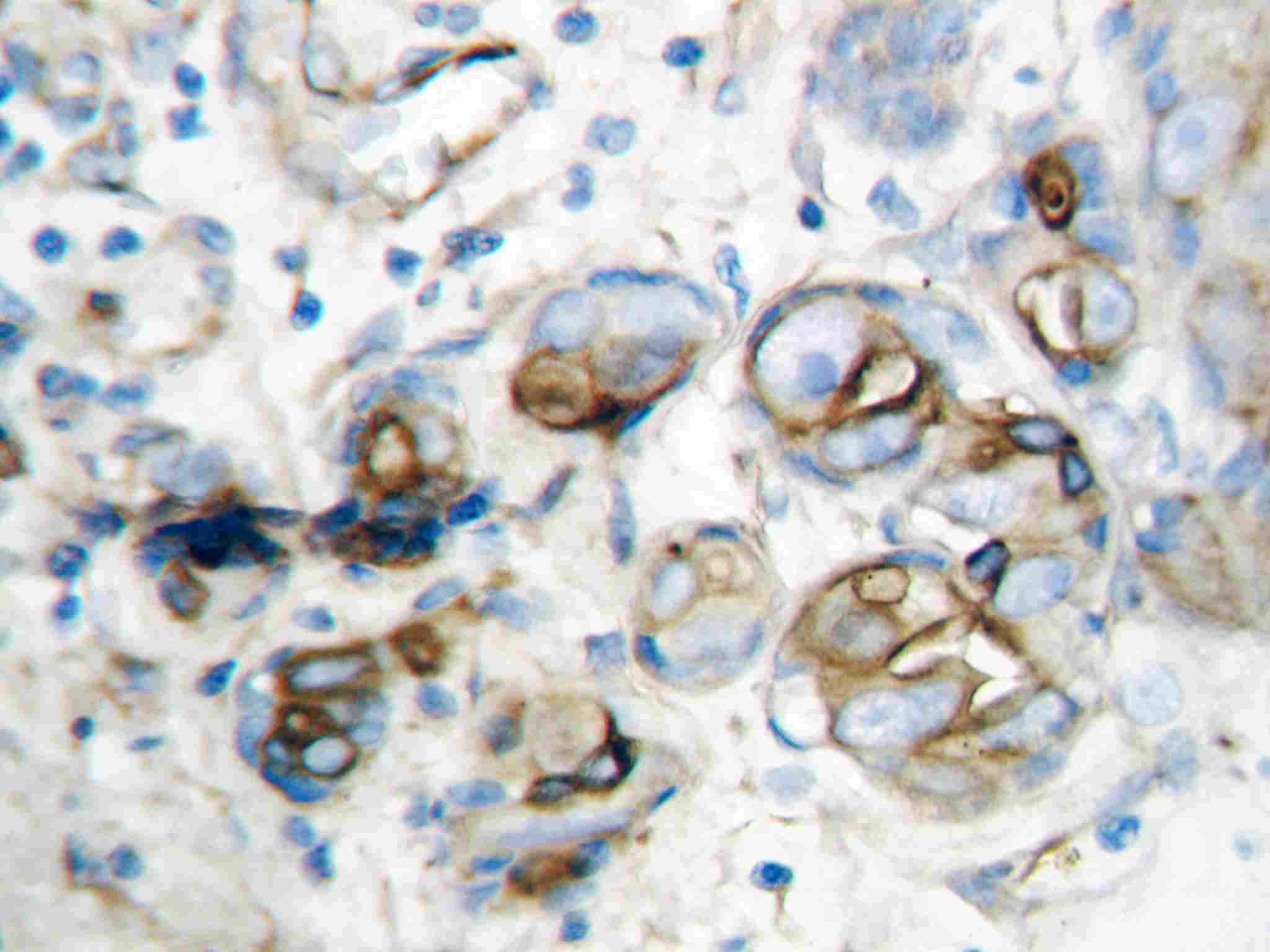2 - Anti-CXCL10/IP-10 Antibody ABO10719