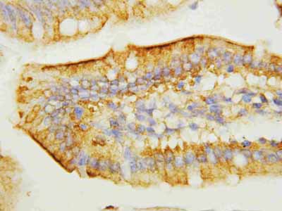 2 - Anti-EGF Antibody ABO10721