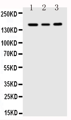 1 - Anti-VEGFR1/FLT1 Antibody ABO10722