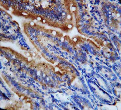 2 - Anti-Fractalkine/CX3CL1 Antibody ABO10724