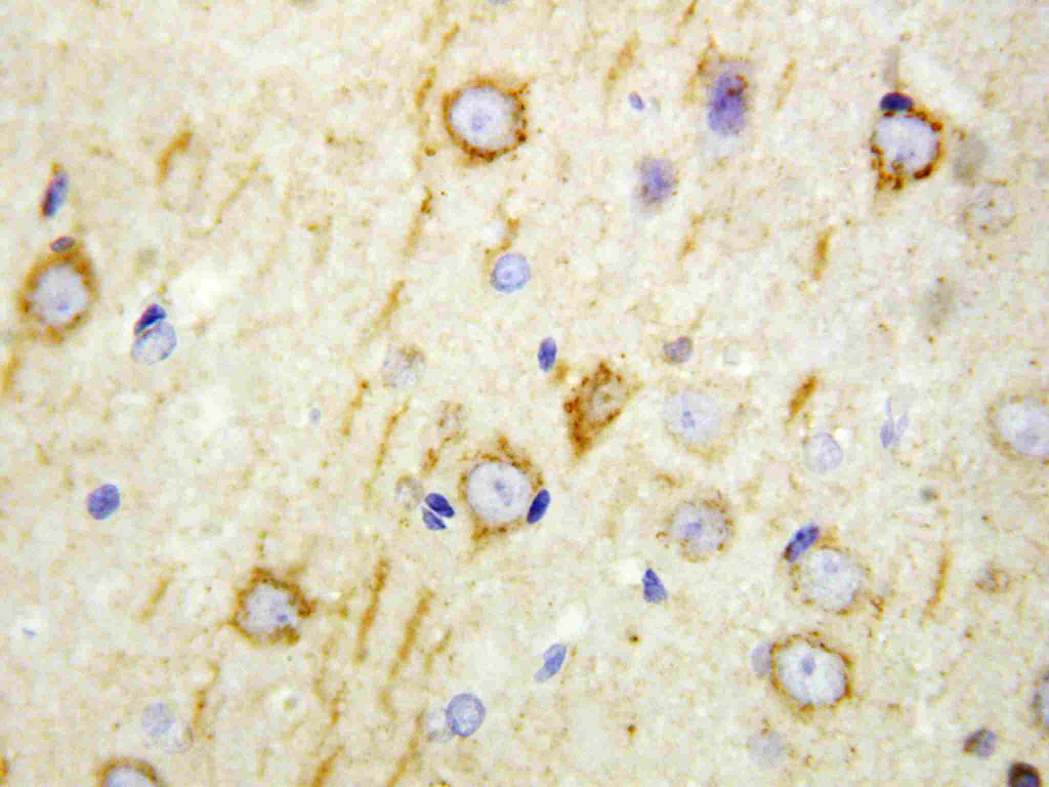 2 - Anti-GAD65 Antibody ABO10726