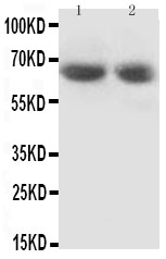 1 - Anti-GAD65 Antibody ABO10726