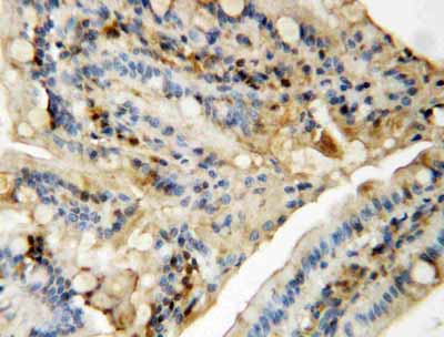 2 - Anti-MAPK8/9 Antibody ABO10730