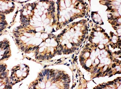 2 - Anti-MAPK8/9 Antibody ABO10730